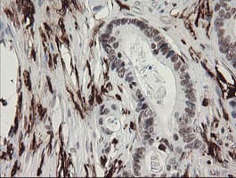 F13A1 / Factor XIIIa Antibody (clone 6F5, Carrier-free)
