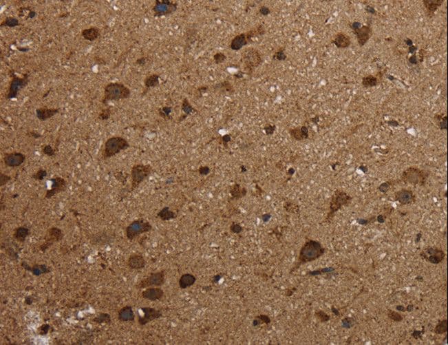 Polyclonal Rabbit anti-Human HSD17B13 Antibody (IHC, WB)