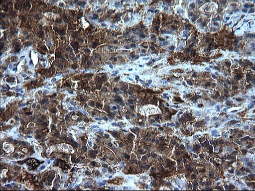 FGG / Fibrinogen Gamma Antibody (clone OTI2D2)