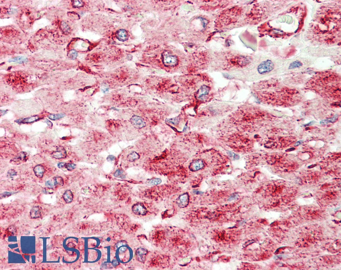 IHC-plus™ TUBA8 / Tubulin Alpha 8 Antibody (clone 2D6)