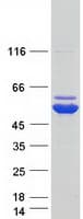 Human AHCYL1 / DCAL Protein (Recombinant Myc-DDK (Flag))