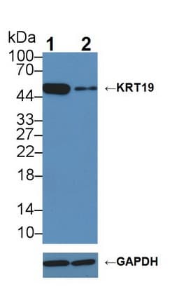 KRT19 / CK19 / Cytokeratin 19 Antibody (aa245-391)