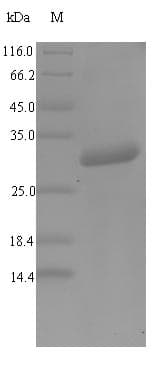 Mouse DEFA1 / Defensin Alpha 1 Protein (Recombinant GST, N-terminus)