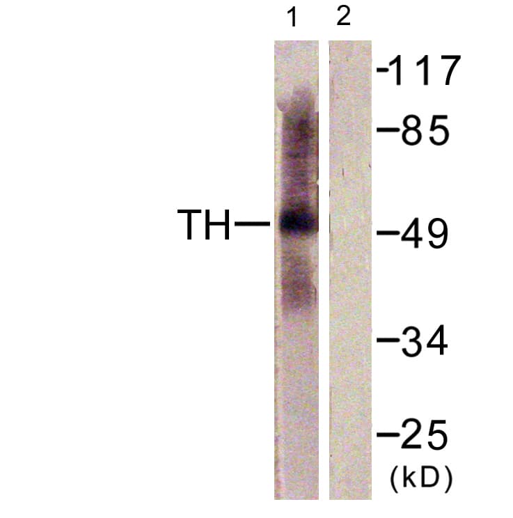 PathPlus™ TPH1 / Tryptophan Hydroxylase Antibody (aa26-75)