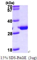 Human PMM2 Protein (Recombinant His)