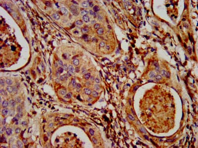 Polyclonal Rabbit anti-Human NLRP7 / NALP7 Antibody (IHC)