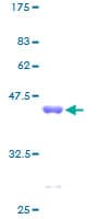 Human UQCRH Protein (Recombinant GST)