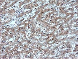 MAP2K1 / MKK1 / MEK1 Antibody (clone OTI3H3)