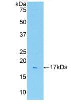 Rat IL1R1 Protein (Recombinant His, N-Terminal)