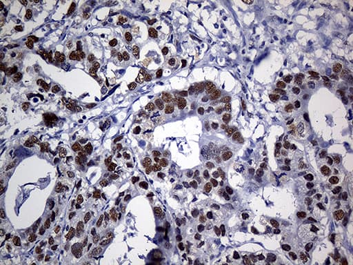 Monoclonal Mouse anti-Human PPP2R1B Antibody (clone OTI8B6, Carrier-free, aa19-601, IHC, WB)