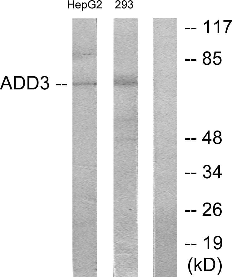 Polyclonal Rabbit anti-Human ADD3 Antibody (WB)