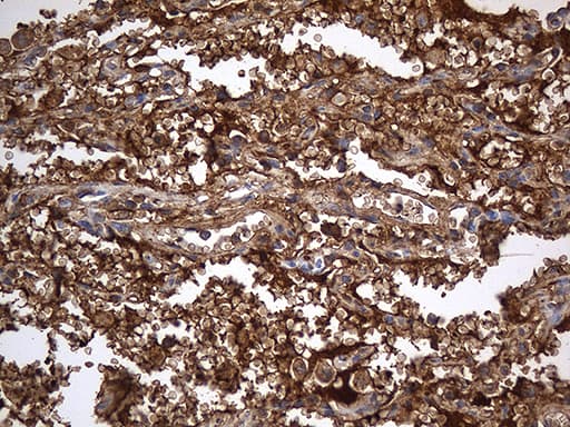 ACE / CD143 Antibody (aa642-1230, clone OTI2C8)