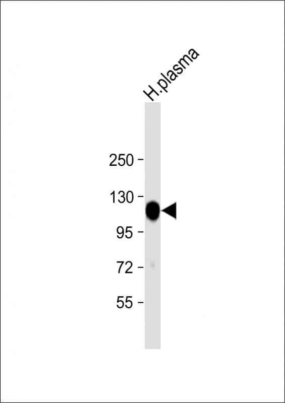 ITIH4 Antibody (aa885-917)