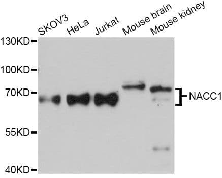 NACC1 / NAC1 Antibody