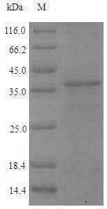 Vaccinia Virus Smallpox-B5R Protein (Recombinant 6His, N-terminus)