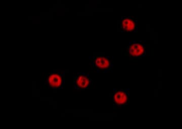 WRN Antibody