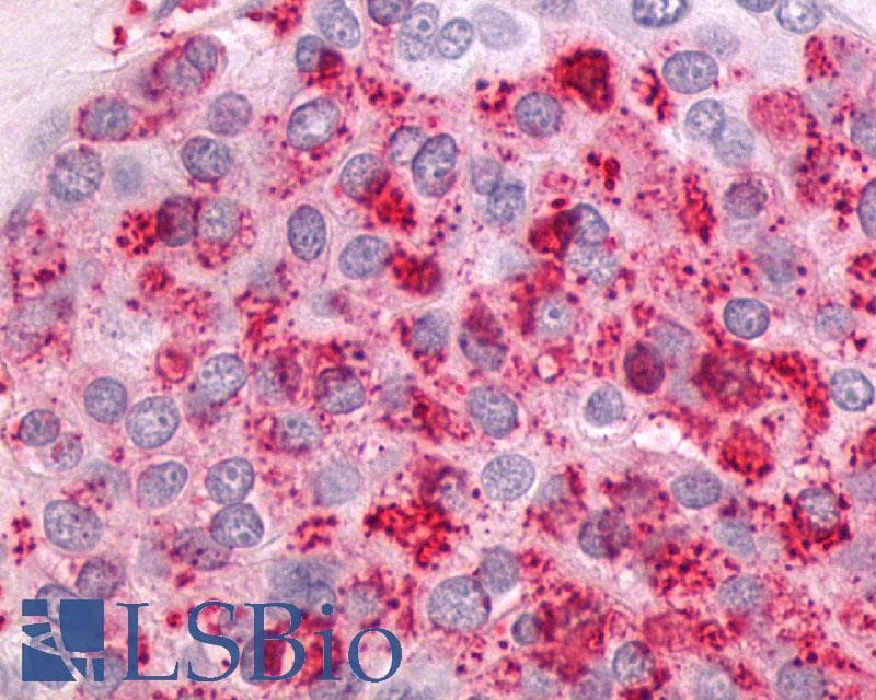 PathPlus™ Polyclonal Rabbit anti-Human NTSR1 / NTR Antibody (N-Terminus, IHC)