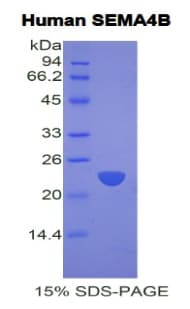 Human SEMA4B / Semaphorin 4B Protein (Recombinant His)