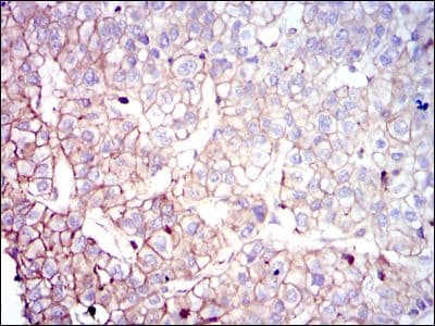 Monoclonal Mouse anti-Human CLP / COTL1 Antibody (clone 5C8, IHC, WB)