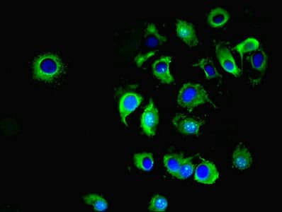 Polyclonal Rabbit anti-Human ATP1A1 Antibody (IHC, IF)