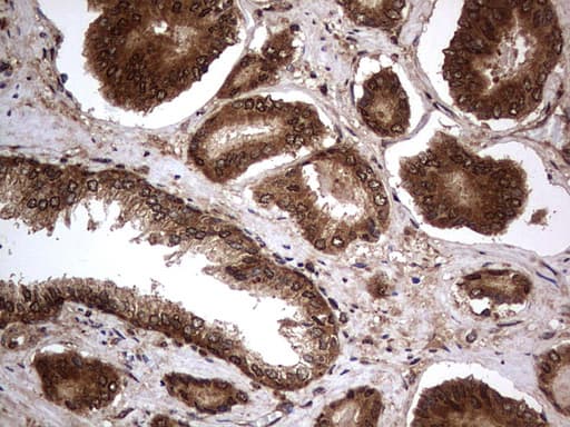 H2AFY2 Antibody (aa2-261, clone OTI1C2)