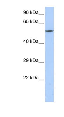 Polyclonal Rabbit anti-Human CACNB1 Antibody (C-Terminus, WB)