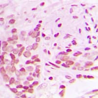 AFF1 / AF4 Antibody (N-Terminus)