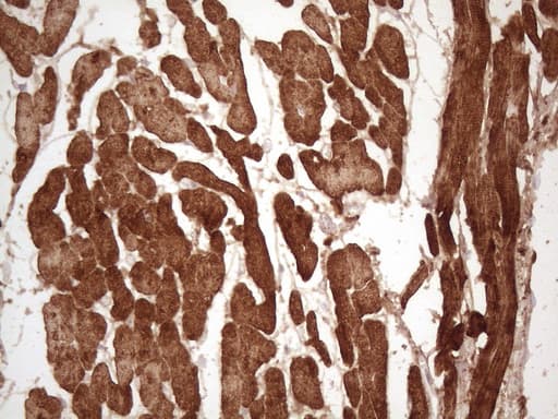 TNNI3 / Cardiac Troponin I Antibody (aa1-210, clone OTI8G8)