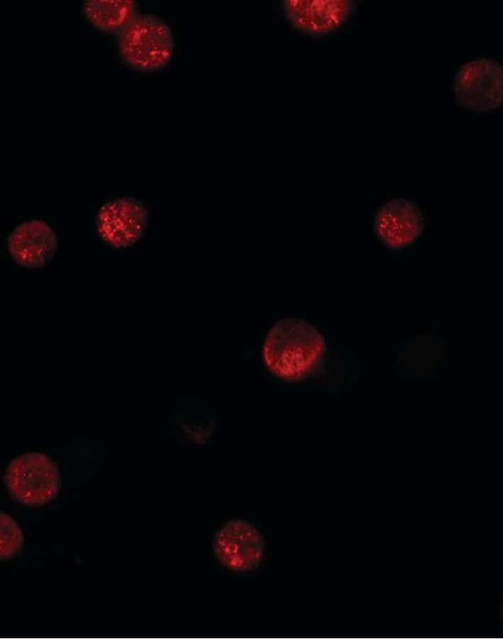 IHC-plus™ Polyclonal Rabbit anti-Human GBP6 Antibody (IHC, IF, WB)