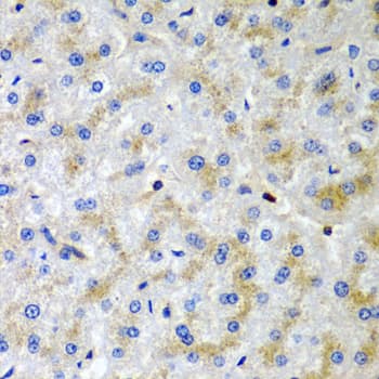 IHC-plus™ Polyclonal Rabbit anti-Human SRGN / Serglycin Antibody (IHC, IF, WB)