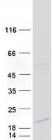 Human DSCR4 Protein (Recombinant Myc-DDK (Flag))