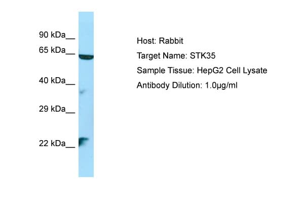 STK35 Antibody (aa106-155)
