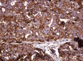 ATP6V1B2 Antibody (clone 1.00E+11, Carrier-free)
