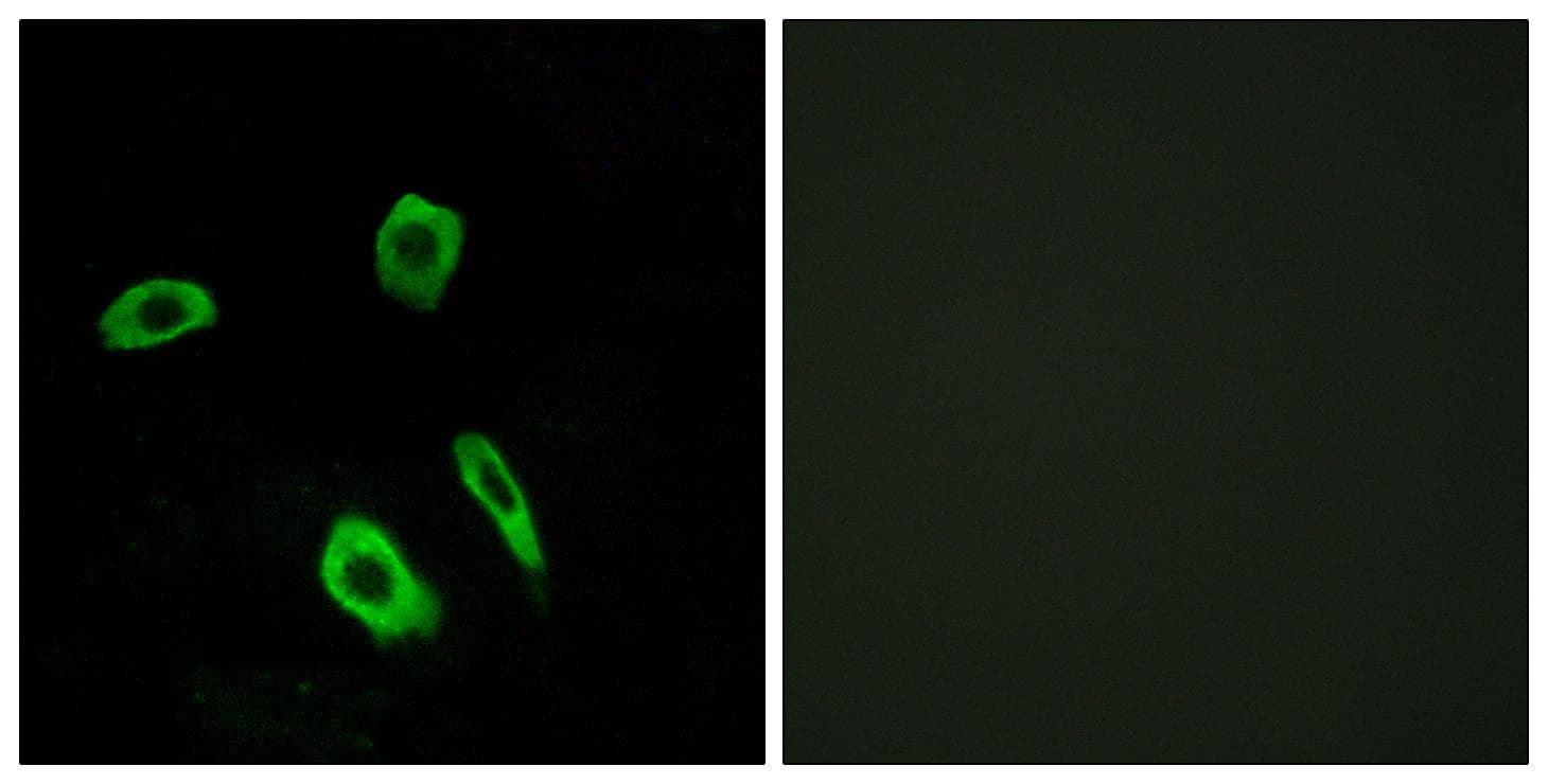 Polyclonal Rabbit anti-Human LPAR3 / LPA3 / EDG7 Antibody (IF, WB)