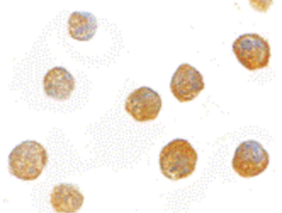 ADAP / FYB Antibody