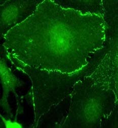 Myc Tag Antibody