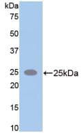 SPTAN1 / Alpha Fodrin Antibody (aa2071-2269, APC)