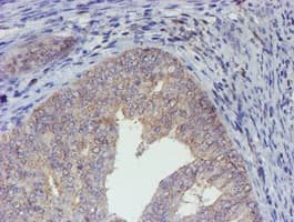 ELK3 / NET Antibody (clone OTI4G9)