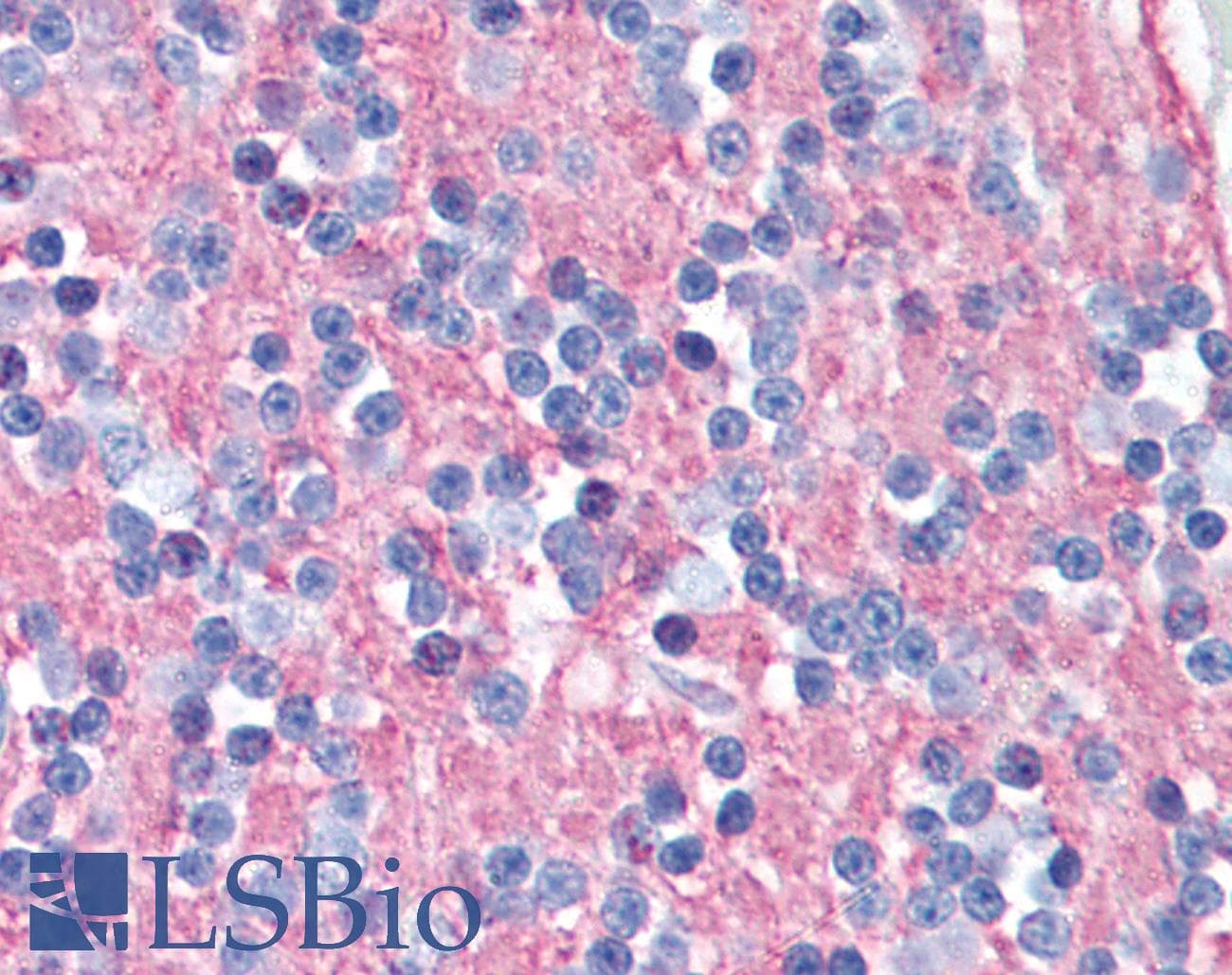 IHC-plus™ SNAP25 Antibody (clone SP12)
