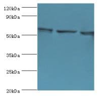 Polyclonal Rabbit anti-Human COIL / Coilin Antibody (aa297-576, IHC, WB)