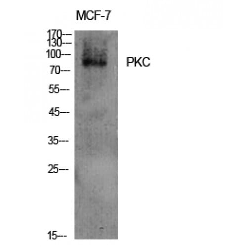 PKC / Protein Kinase C Antibody (600-680 aa)