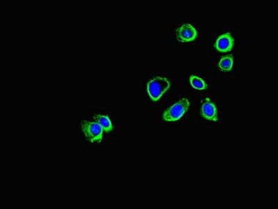 CORO1B Antibody