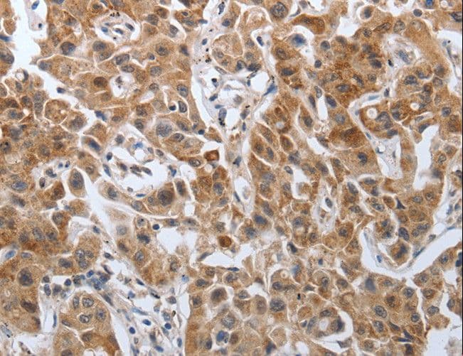 PDGF-AA Antibody