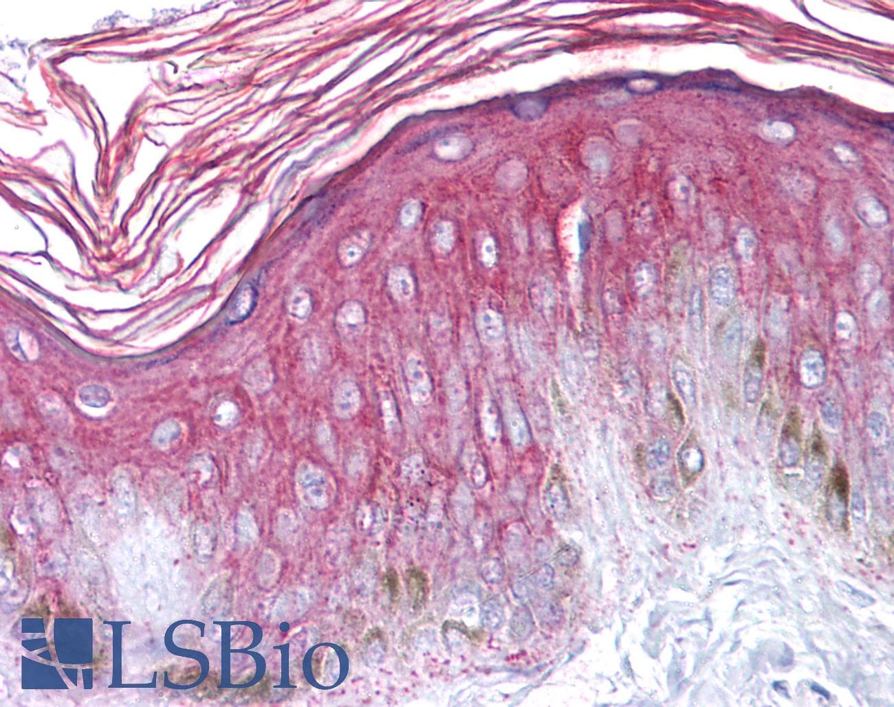 IHC-plus™ KRT18 / CK18 / Cytokeratin 18 Antibody (clone AT2G3)