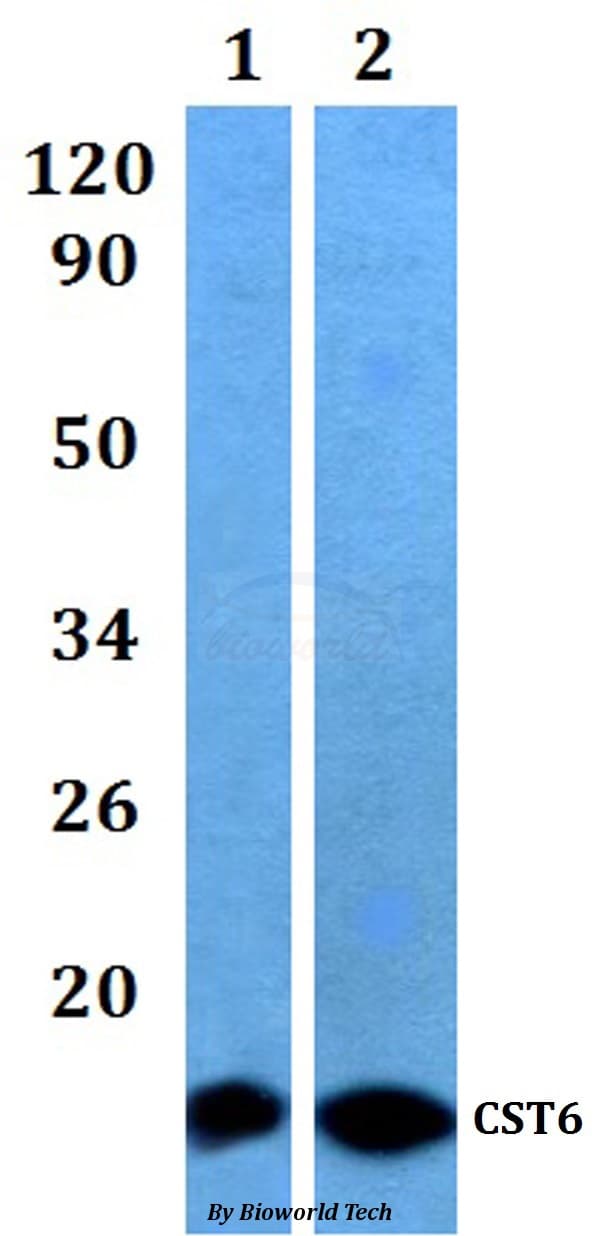 CST6 / Cystatin E/M Antibody