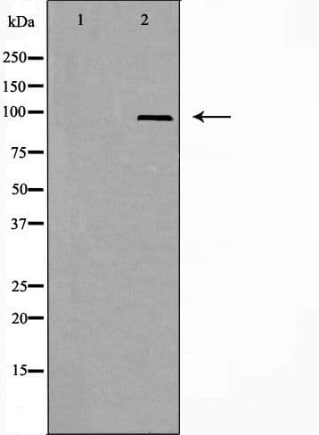 ANKRD20A1 Antibody