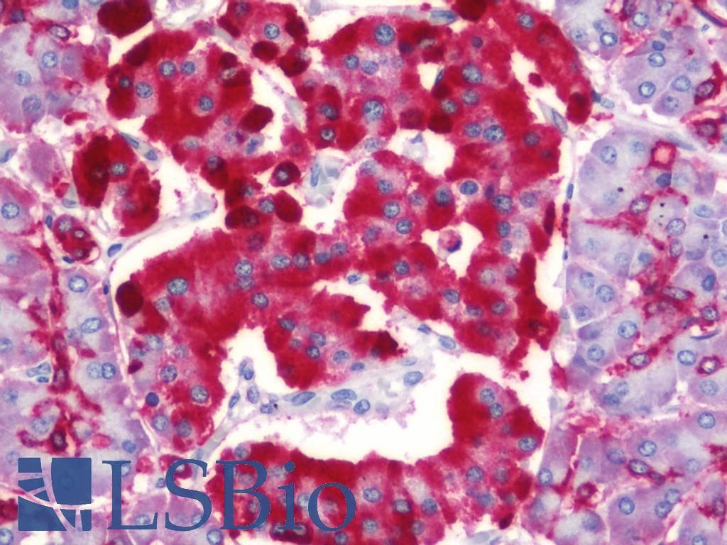 IHC-plus™ Polyclonal Rabbit anti-Human SCG2 / Secretogranin II Antibody (aa272-542, IHC, WB)