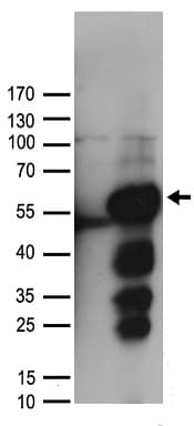 ALDH9A1 Antibody