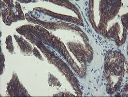 DPH2 Antibody (clone OTI3A12)