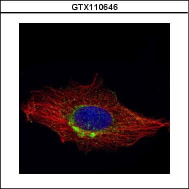 IHC-plus™ RAB6A / RAB6 Antibody (aa1-208)
